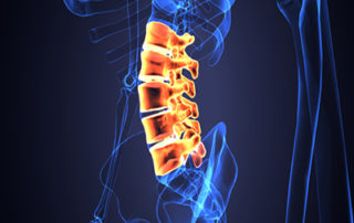 image of spinal cord xray