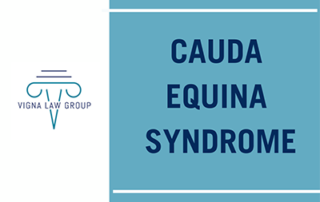 Cauda Equina Syndrome - Vigna Law Group
