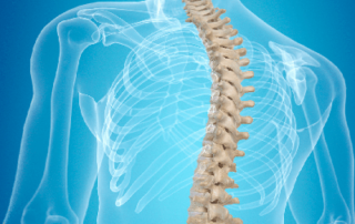 illustration of a human spine - malpractice litigation Vigna Law Group