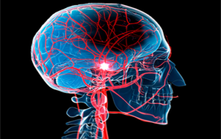 neurological illustration of human head