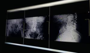 x rays being illuminated