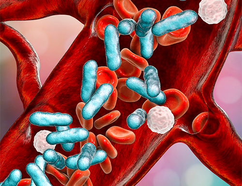 Hospital Acquired Acinetobacter Bloodstream Infections: The Risk Factors