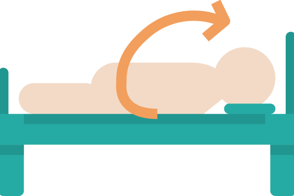 pressure sore, decubitus ulcer illustration