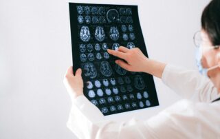 Doctor pointing at brain scan